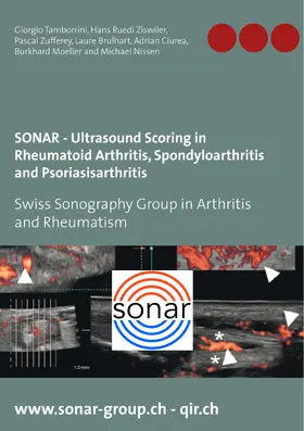 Tamborrini / Ziswiler / Zufferey |  SONAR - Ultrasound Scoring in Rheumatoid Arthritis, Spondyloarthritis and Psoriasisarthritis | eBook | Sack Fachmedien