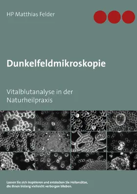 Felder |  Dunkelfeldmikroskopie | eBook | Sack Fachmedien