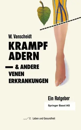 Vanscheidt |  Krampfadern und andere Venenerkrankungen | Buch |  Sack Fachmedien