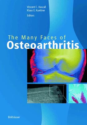 Kuettner / Hascall |  The Many Faces of Osteoarthritis | Buch |  Sack Fachmedien