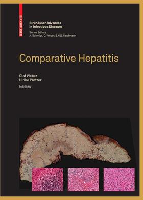 Weber / Schmidt / Protzer |  Comparative Hepatitis | eBook | Sack Fachmedien