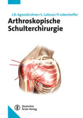 Agneskirchner / Lafosse / Lobenhoffer |  Arthroskopische Schulterchirurgie | Buch |  Sack Fachmedien