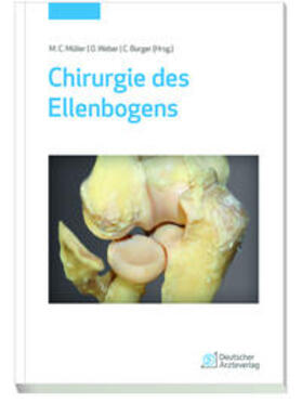 Müller / Weber / Burger |  Chirurgie des Ellenbogens | Buch |  Sack Fachmedien
