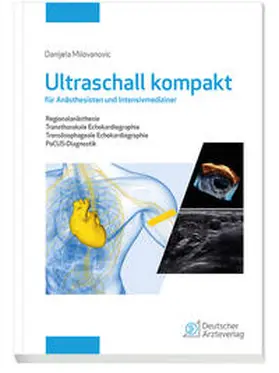 Milovanovic |  Ultraschall kompakt für Anästhesisten und Intensivmediziner | Buch |  Sack Fachmedien