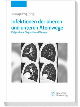 Ewig |  Infektionen der oberen und unteren Atemwege | eBook | Sack Fachmedien