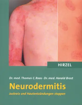 Roos / Brost |  Neurodermitis | Buch |  Sack Fachmedien