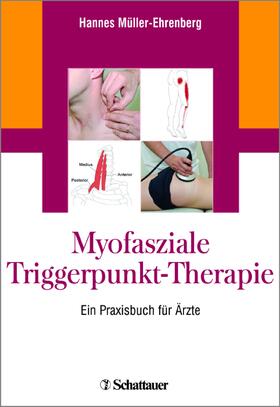 Müller-Ehrenberg |  Myofasziale Triggerpunkt-Therapie | Buch |  Sack Fachmedien