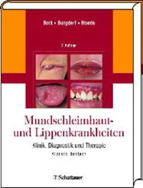 Bork / Burgdorf / Hoede |  Mundschleimhaut- und Lippenkrankheiten | eBook | Sack Fachmedien