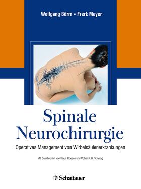 Börm / Meyer |  Spinale Neurochirurgie | eBook | Sack Fachmedien