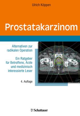 Köppen |  Prostatakarzinom | eBook | Sack Fachmedien