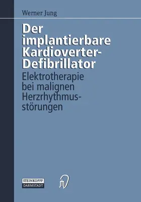 Jung |  Der implantierbare Kardioverter-Defibrillator | Buch |  Sack Fachmedien