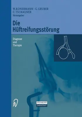 Konermann / Tschauner / Gruber |  Die Hüftreifungsstörung | Buch |  Sack Fachmedien