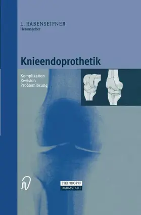 Rabenseifner |  Knieendoprothetik | Buch |  Sack Fachmedien