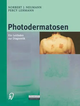 Lehmann / Neumann |  Photodermatosen | Buch |  Sack Fachmedien