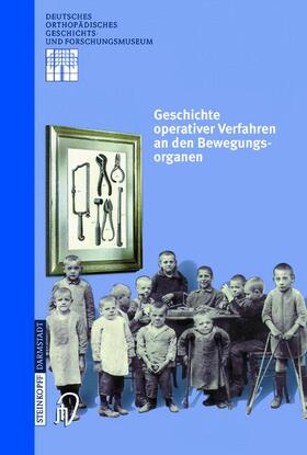 Zichner / Thomann / Rauschmann |  Geschichte operativer Verfahren an den Bewegungsorganen | Buch |  Sack Fachmedien