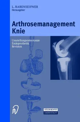 Rabenseifner |  Arthrosemanagement Knie | Buch |  Sack Fachmedien