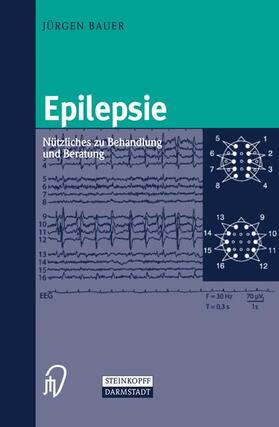Bauer |  Epilepsie | Buch |  Sack Fachmedien