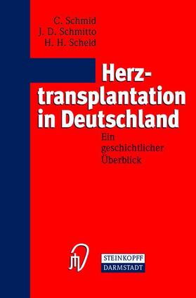 Schmid / Scheld / Schmitto |  Herztransplantation in Deutschland | Buch |  Sack Fachmedien