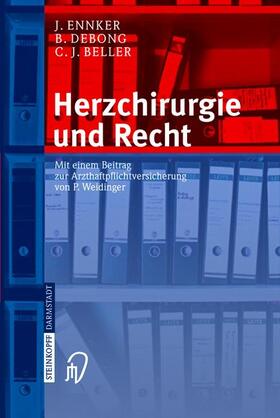 Ennker / Beller / Debong |  Herzchirurgie und Recht | Buch |  Sack Fachmedien