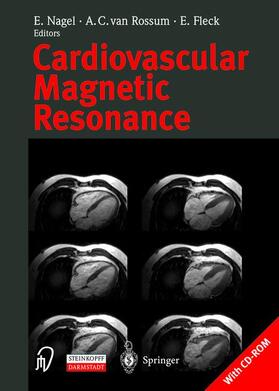 Nagel / Fleck / Rossum |  Cardiovascular Magnetic Resonance | Buch |  Sack Fachmedien