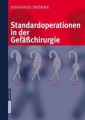 Frömke |  Standardoperationen in der Gefäßchirurgie | Buch |  Sack Fachmedien