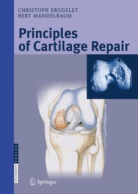 Mandelbaum / Erggelet |  Principles of Cartilage Repair | Buch |  Sack Fachmedien