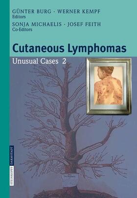 Burg / Kempf |  Cutaneous Lymphomas | eBook | Sack Fachmedien