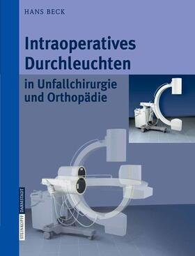 Beck |  Intraoperatives Durchleuchten in Unfallchirurgie und Orthopädie | eBook | Sack Fachmedien