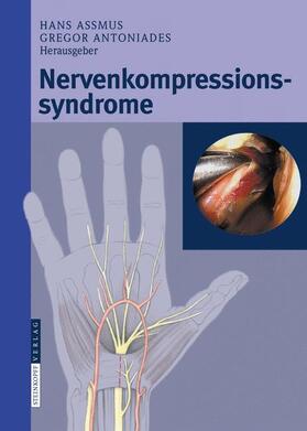 Assmus / Antoniadis |  Nervenkompressionssyndrome | Buch |  Sack Fachmedien