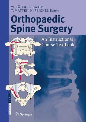 Käfer / Reichel / Cakir |  Orthopaedic Spine Surgery | Buch |  Sack Fachmedien