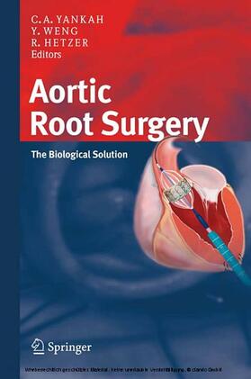 Yankah / Bechtel / Weng |  Aortic Root Surgery | eBook | Sack Fachmedien