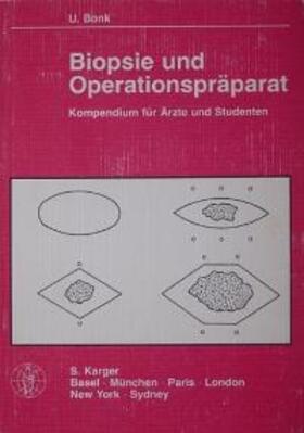 Bonk |  Biopsie und Operationspräparat | Buch |  Sack Fachmedien