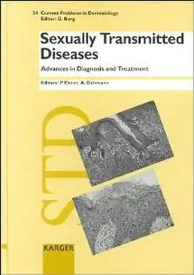 Elsner / Eichmann |  Sexually Transmitted Diseases: Advances in Diagnosis and Treatment | Buch |  Sack Fachmedien