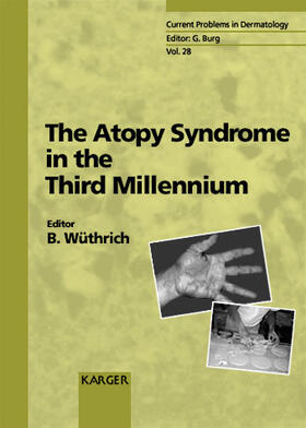 Wüthrich |  The Atopy Syndrome in the Third Millennium | Buch |  Sack Fachmedien