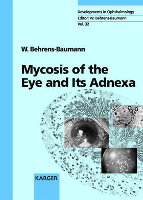 Behrens-Baumann |  Mycosis of the Eye and Its Adnexa | Buch |  Sack Fachmedien