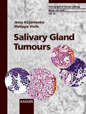 Klijanienko / Vielh |  Salivary Gland Tumours | Buch |  Sack Fachmedien