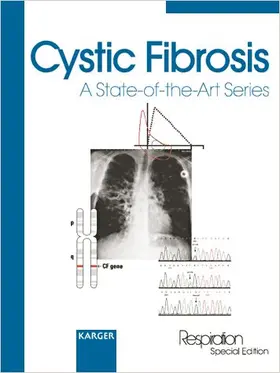  Cystic Fibrosis | Buch |  Sack Fachmedien