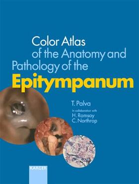 Palva / Ramsay / Northrop |  Color Atlas of the Anatomy and Pathology of the Epitympanum | Buch |  Sack Fachmedien