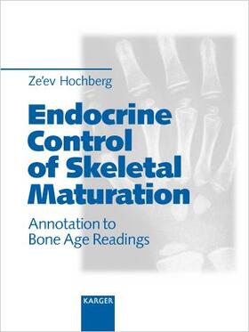 Hochberg |  Endocrine Control of Skeletal Maturation | Buch |  Sack Fachmedien