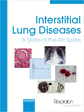 Olivieri |  Interstitial Lung Diseases | Buch |  Sack Fachmedien