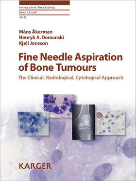Akerman / Åkerman / Domanski |  Fine-Needle Aspiration of Bone Tumors | Buch |  Sack Fachmedien