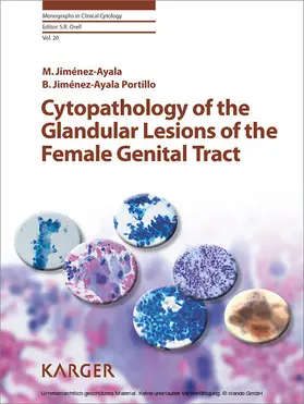 Jiménez-Ayala / Viehl |  Cytopathology of the Glandular Lesions of the Female Genital Tract | eBook | Sack Fachmedien