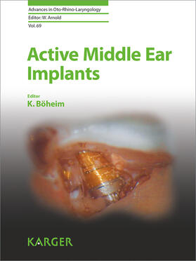 Böheim |  Active Middle Ear Implants | eBook | Sack Fachmedien