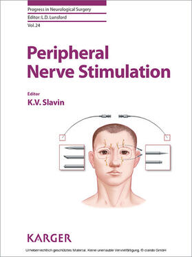 Slavin |  Peripheral Nerve Stimulation | eBook | Sack Fachmedien