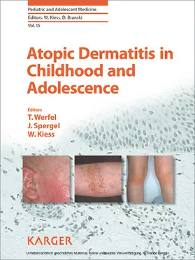 Werfel / Kiess / Spergel |  Atopic Dermatitis in Childhood and Adolescence | eBook | Sack Fachmedien