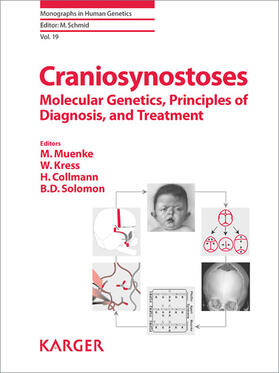 Schmid / Muenke / Kress |  Craniosynostoses | eBook | Sack Fachmedien