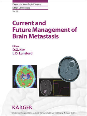 Kim / Lunsford |  Current and Future Management of Brain Metastasis | eBook | Sack Fachmedien