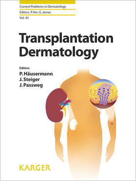 Häusermann / Passweg / Steiger |  Transplantation Dermatology | eBook | Sack Fachmedien