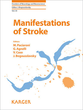 Paciaroni / Agnelli / Caso |  Manifestations of Stroke | eBook | Sack Fachmedien