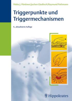 Pöntinen / Pöntinen, MD / Gleditsch |  Triggerpunkte und Triggermechanismen | Buch |  Sack Fachmedien